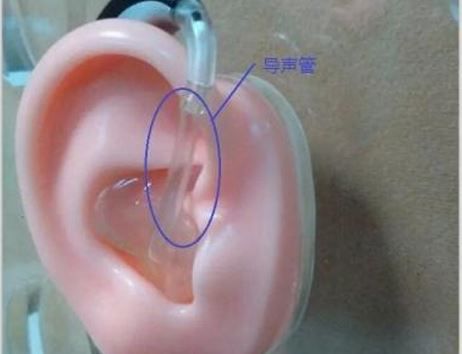 What To Do If The Sound Guide Tube Of The Hearing Aid Has Water Drops